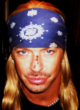 Bret Michaels, Tony Awards, injuries, face, lip, pictures, picture, photos, photo, pics, pic, images, image, hot, sexy, latest, new